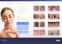 REVYPEEL The non injectable biiorevitaliser-4