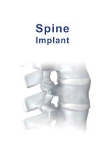 Trauma & Spine Catalog-8