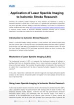 RWD Application of Laser Speckle Imaging to Ischemic Stroke Research - 1