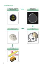 kontour Custom-made cranial implant general catalog-6