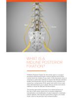 MARINER®  MIDLINE-4