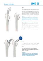 Lubinus SP II Anatomically Adapted Cemented Hip System - 10