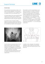 Lubinus SP II Anatomically Adapted Cemented Hip System - 5