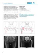 Lubinus SP II Anatomically Adapted Cemented Hip System - 6