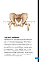 Anterior Approach Patient Education - 3