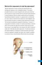 Anterior Approach Patient Education - 5