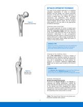 EXACTECH HIP Operative Technique - 5