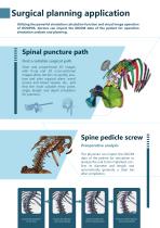 OOOPDS Pre- Surgical Planning Software-6