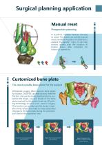 OOOPDS Pre- Surgical Planning Software-7
