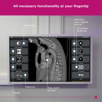 FLUID - TOUCHLESS MEDICAL IMAGE NAVIGATION SYSTEM FOR SURGERY - 7