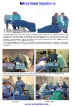 Recommendation for the implementation of intravitreal injections-3