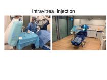 Should intravitreal injections be performed in an office setting or in the operating room-4