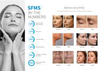 SFMS™-5