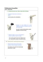 Reconstruction du Ligament Croisé Antérieur par technique Kenneth Jones ou DIDT-4