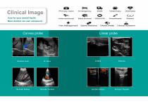 WiFi&USB3in1ColorUltrasound-3