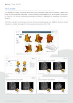 TALUS OSTEOTOMY-5