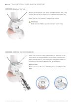 TALUS OSTEOTOMY-7