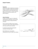PediLoc ® Extension Osteotomy-4
