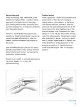 PediLoc ® Extension Osteotomy-5