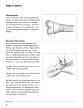 PediLoc ® Extension Osteotomy-6