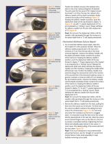 meniscal repair all inside-7