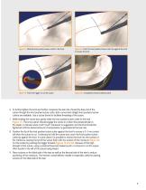 meniscal repair all inside-8