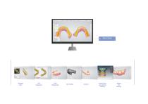 Intraoral scanner P3+-5