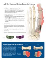 Axi+Line® Proximal Bunion Correction System-2