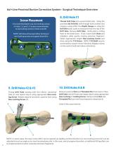 Axi+Line® Proximal Bunion Correction System-6