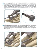 InCore TMT System-10
