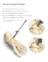 InCore TMT System-12