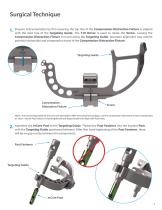 InCoreTM Lapidus System-3