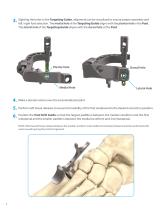 InCoreTM Lapidus System-4