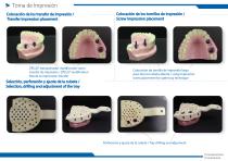 Open tray impression technique on internal connection  implants with ZPLUS®-2