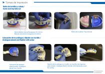 Open tray impression technique on internal connection  implants with ZPLUS®-4