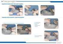 ZM8® All-On-Four workshop-3