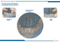 ZM8® All-On-Four workshop-7