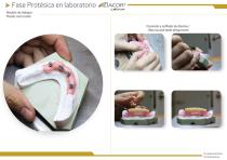 ZM8® All-On-Four workshop-9