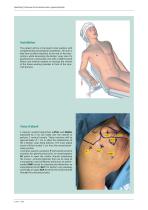 OPERATING TECHNIQUE - ACROMIOCLAVICULAR LIGAMENTOPLASTY-3