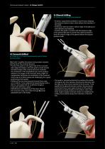 OPERATING TECHNIQUE - BANKART LATARJET-4