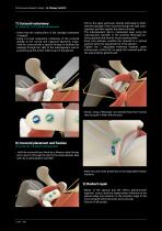 OPERATING TECHNIQUE - BANKART LATARJET-6