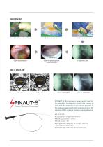 Spinaut-V Video guided catheter-3