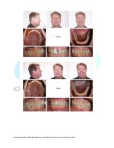 Multidisciplinary Orthodontic Restorative Treatment Plan - 2