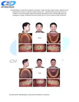 Multidisciplinary Restorative Orthodontic Treatment - 1