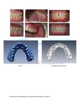 Multidisciplinary Restorative Orthodontic Treatment - 2