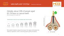 Mini Implants-11