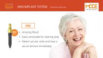 Mini Implants-12