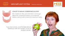 Mini Implants-2