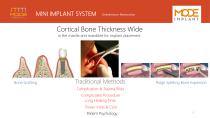Mini Implants-3