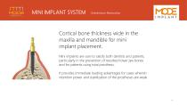 Mini Implants-4